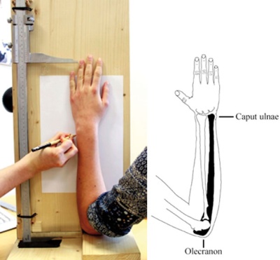ulna-fibula measuring